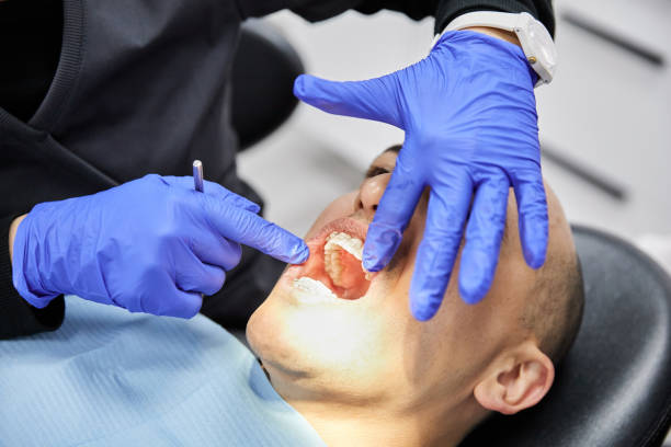 Best Dental Abscess Treatment in Statesville, NC
